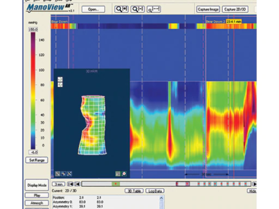 manoscan-ar-analysis-software-f