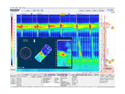 manoscan-eso-analysis-software-f