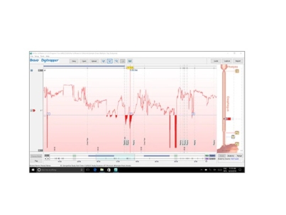 reflux-software-6-1-bx